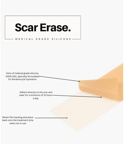 Scar Erase. Medical Grade Silicone Scar Sheet Treatment, Soften and Flattens Scars Resulting from Surgery, Injury, Burns, C-Section and More, Silicone Scar Strips (3cm x 15cm), 6 Week Treatment